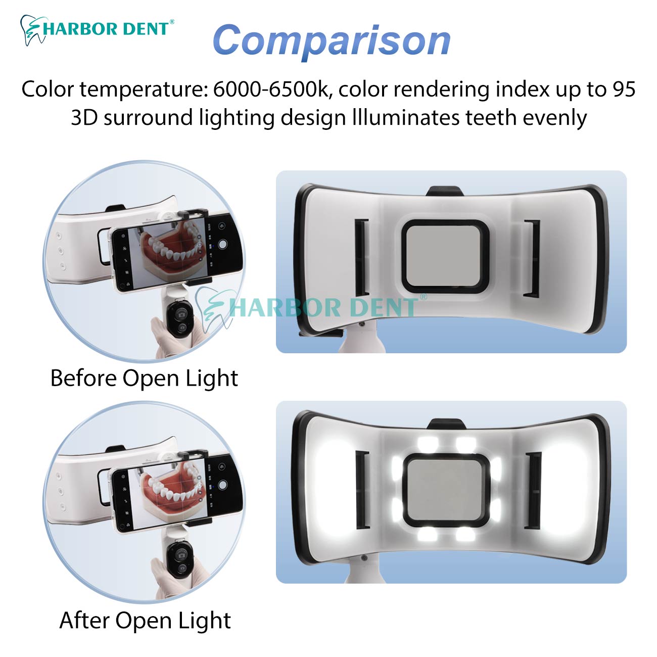 Good Price Dental Photography  - Good Lighting In Photography recensie en prijs
