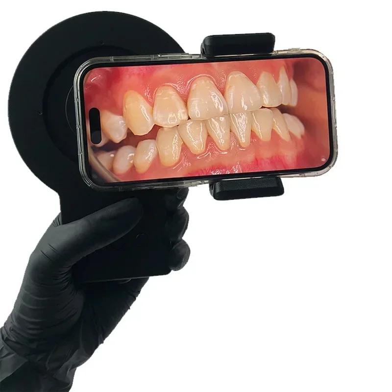 Full Medical MK023 Dental Phot - Photography Lighting Diy recensie en prijs